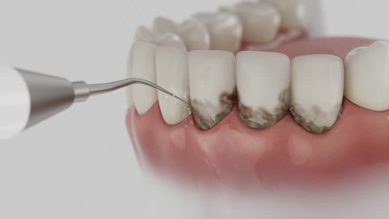Reliable Emergency Dentist contractor in Ferguson, MO by Smile Center Dentistry